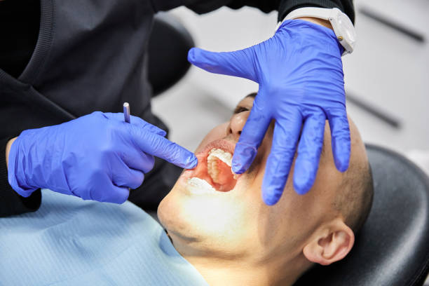 Best Emergency Dental Surgery in Carson, WA